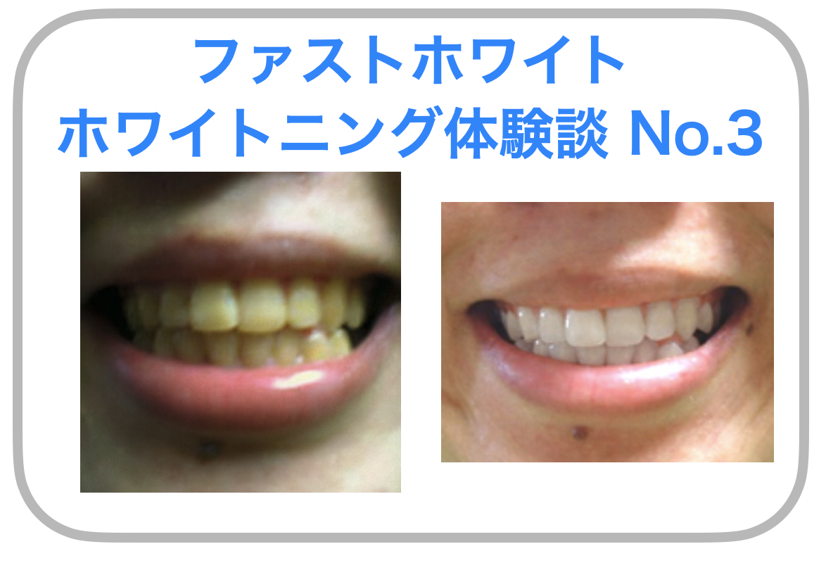 NO.3