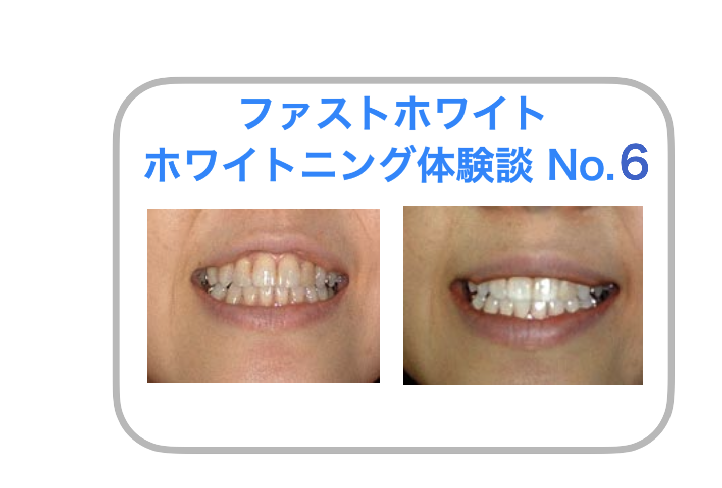 体験談